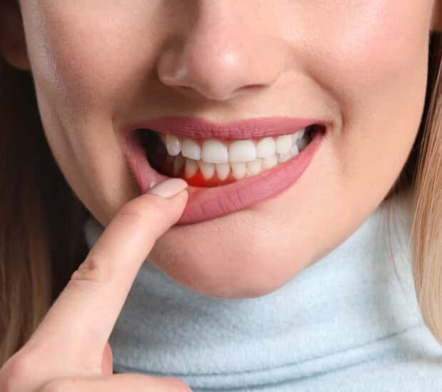 Alpharetta Conditions Linked to Gum Health