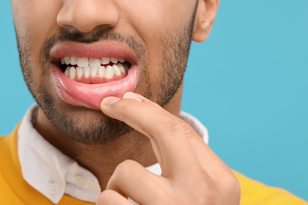 What To Know Before Starting Gum Disease Treatment