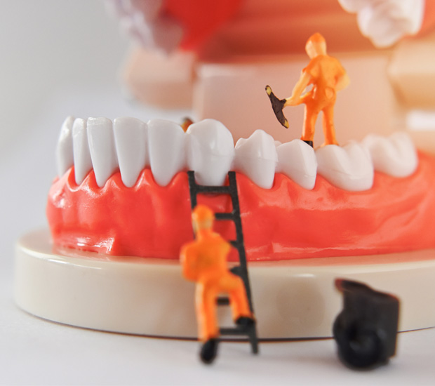 Alpharetta Mini Dental Implants