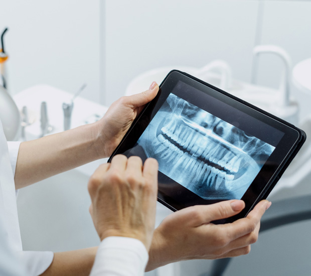 Alpharetta Periodontal Disease