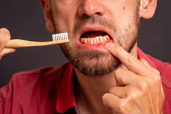 Reasons You Should Consult A Periodontist