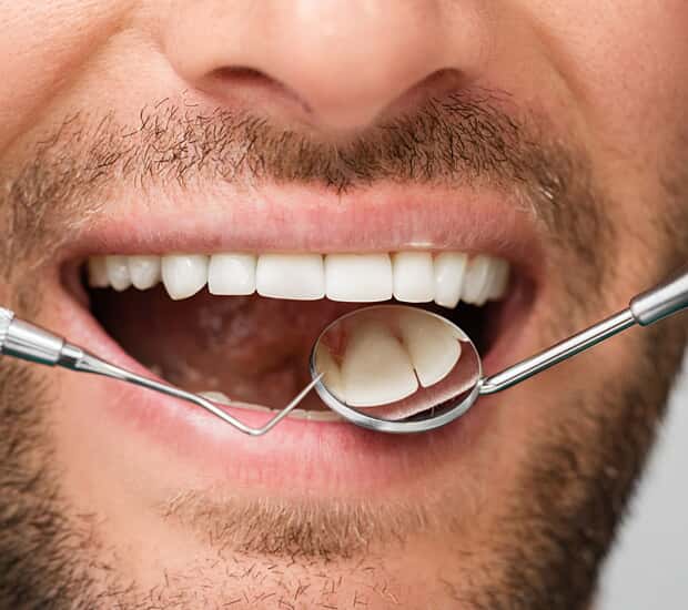 Alpharetta Periodontitis