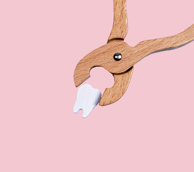 Alpharetta Tooth Extraction